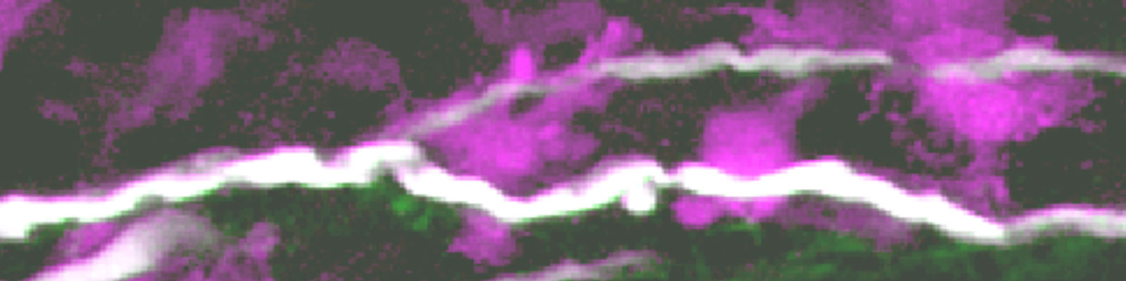 In vivo pathogenesis of immune mediated axon damage
