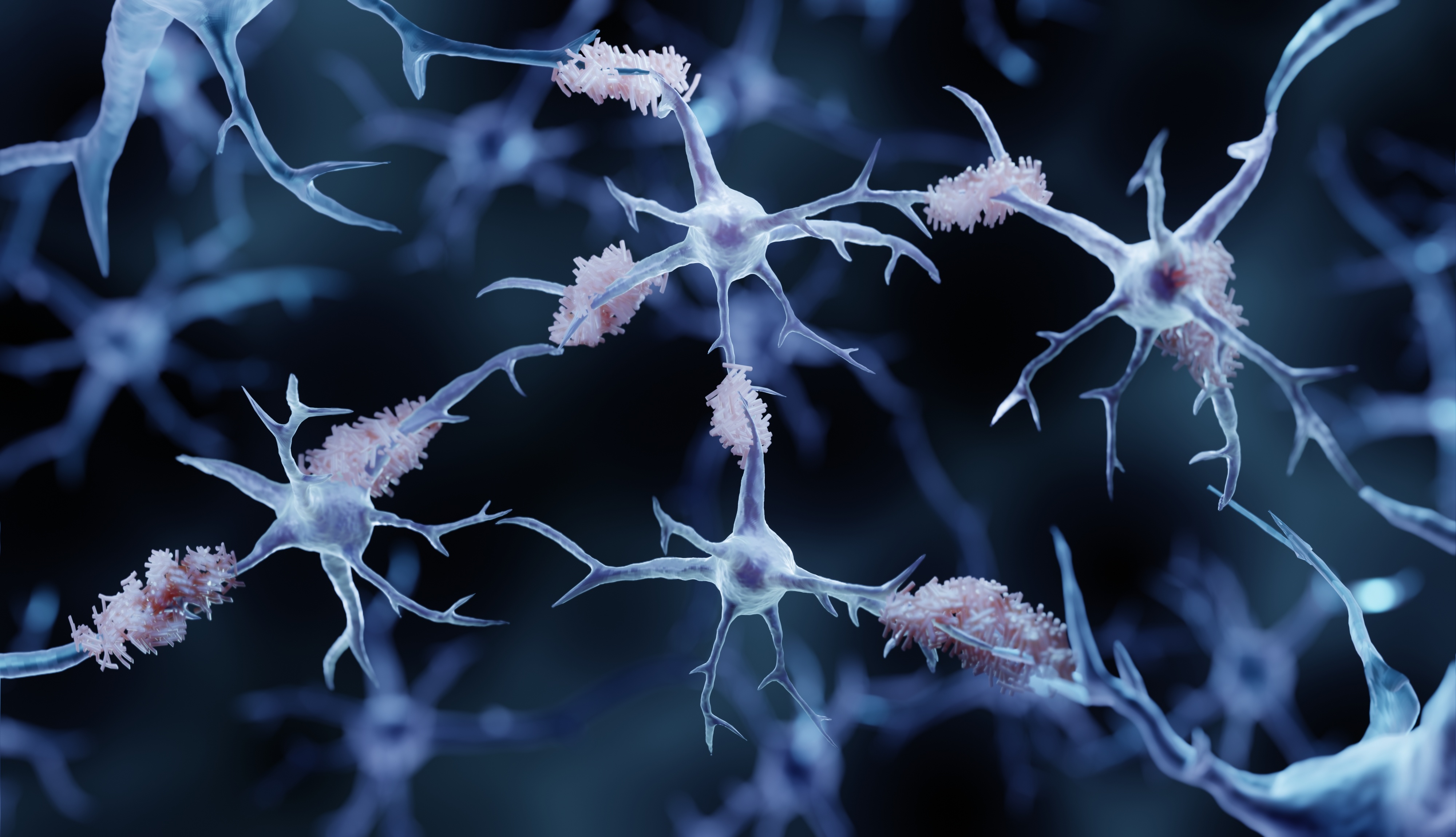 Amyloid-Ablagerungen