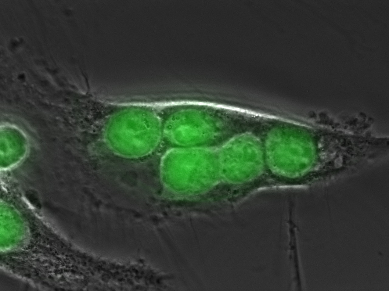 Phagozytose von Lymphomzellen 