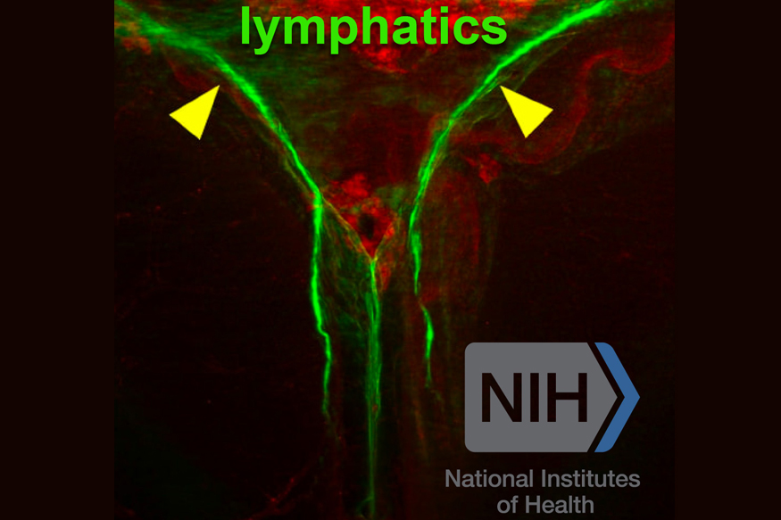 brain lymphatics