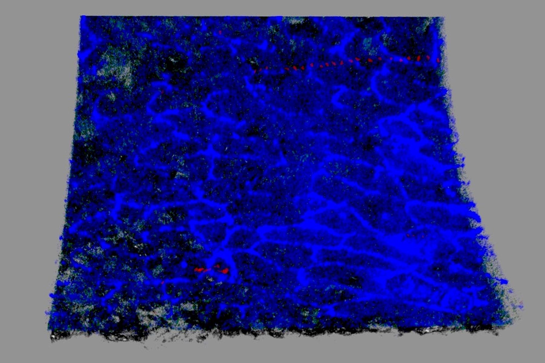 Inner surface of a carotid artery from a mouse treated with the target site blocker; endothelial protein CD in blue.