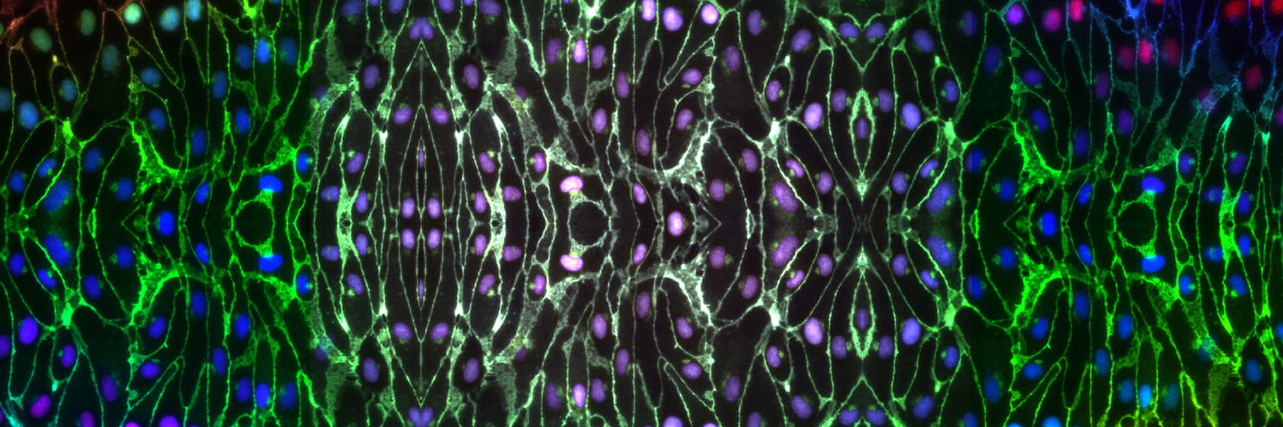 iPSC derived endothelial cells