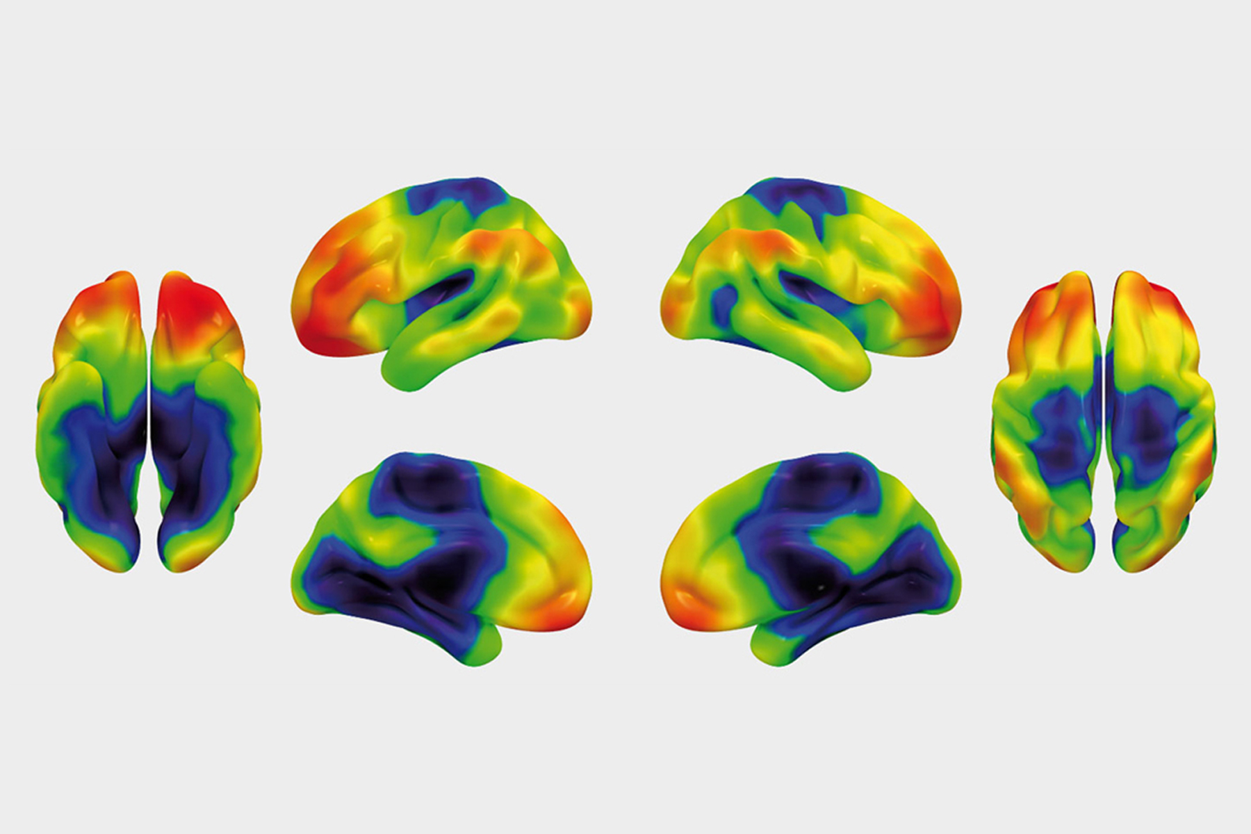 Brain Imaging 