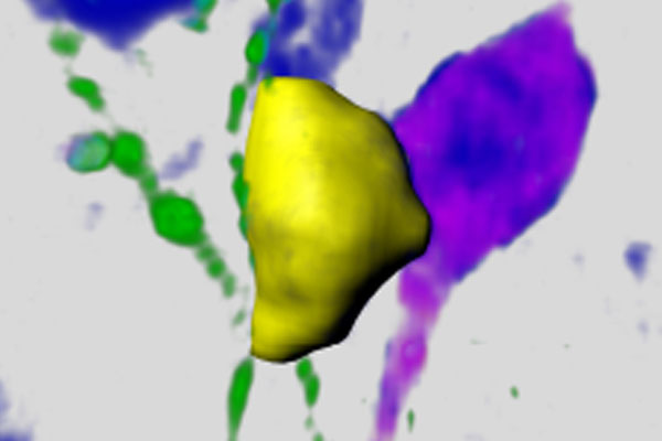 Bareyre Lab image