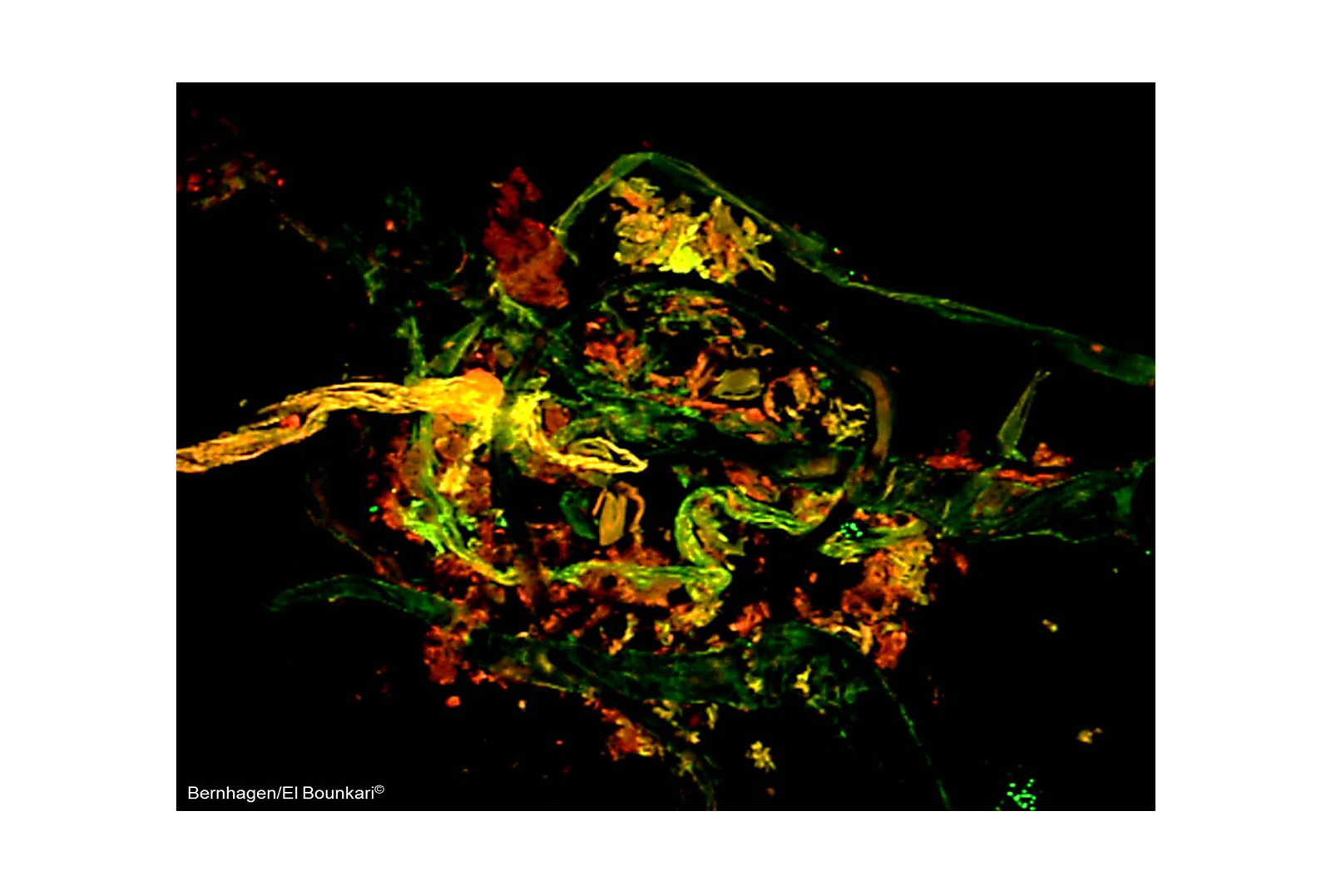 Multi Photon Microscopy