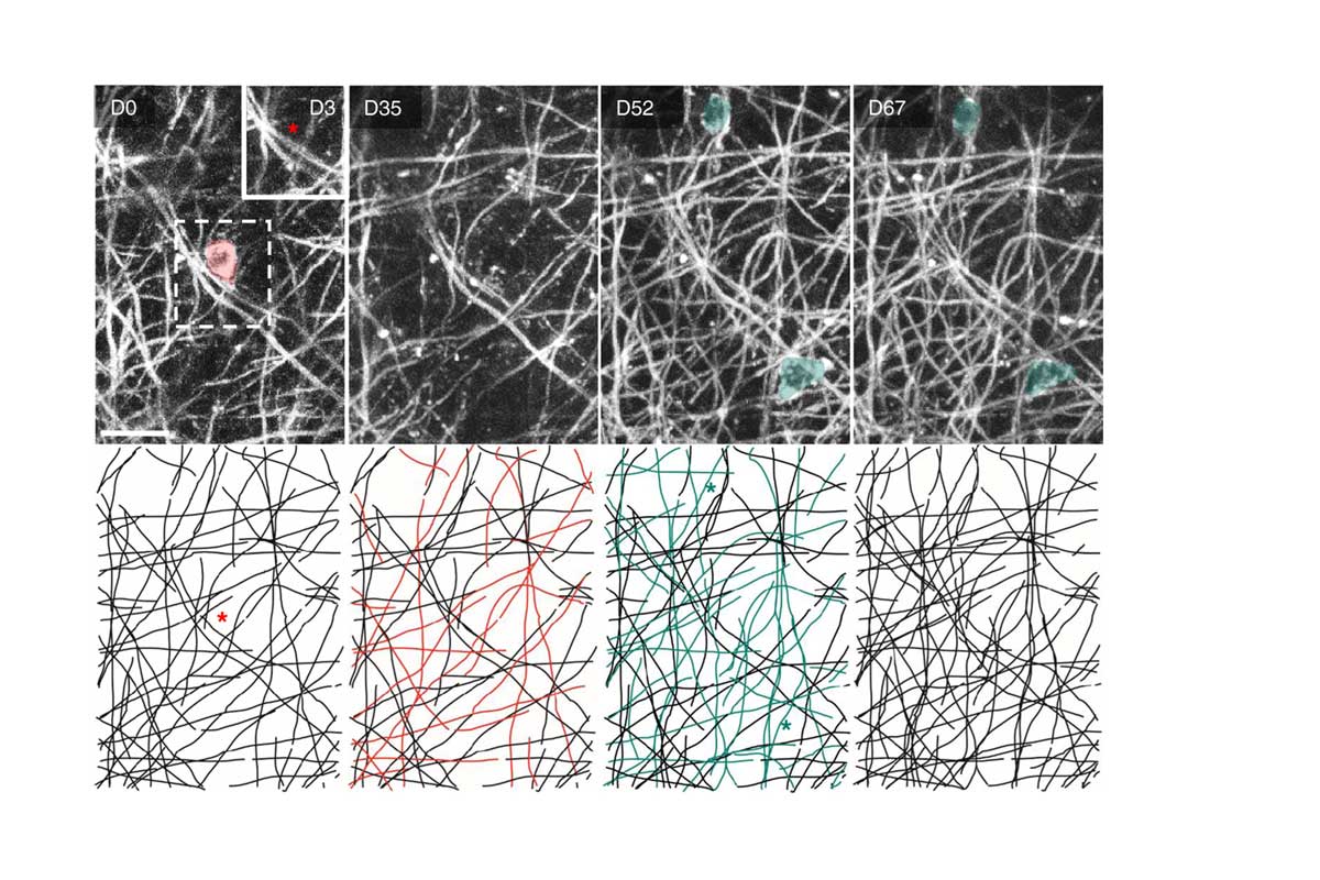 Single cell ablation reveals the rules of myelin replacement