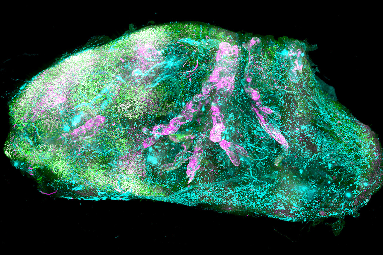3D-Bild eines transparenten Organs (Niere)