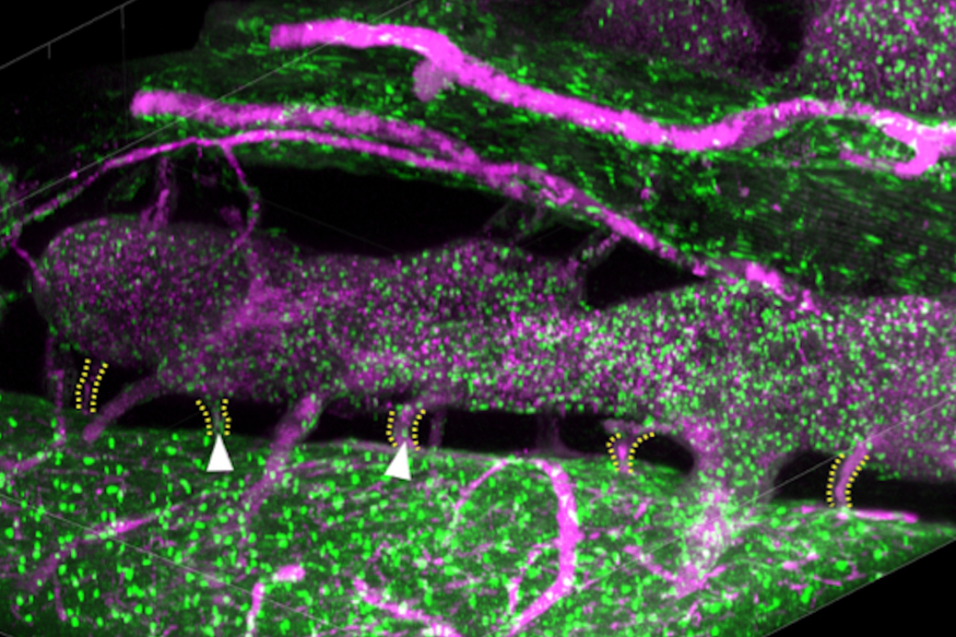 Skull-meninges connections revealed by vDISCO