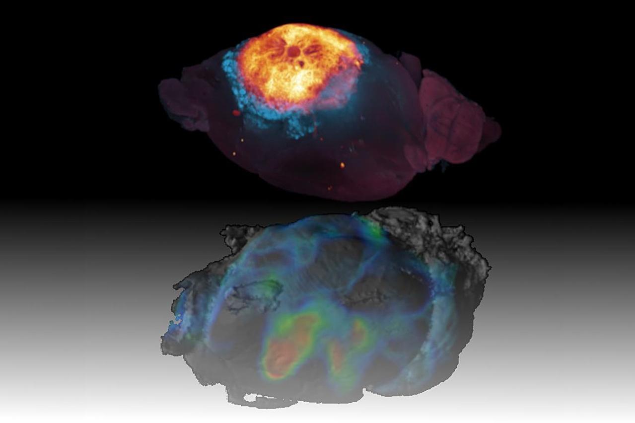 3D-Histologie eines Glioblastoms im Gehirn der Maus (oben) und die gespiegelte, mittels Translokator Protein PET Untersuchung erfasste Realität (unten).