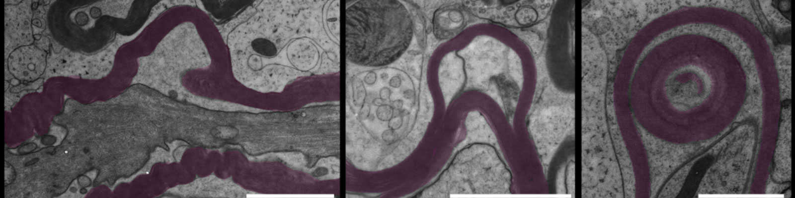 Mechanisms of oligodendrocyte damage and recovery