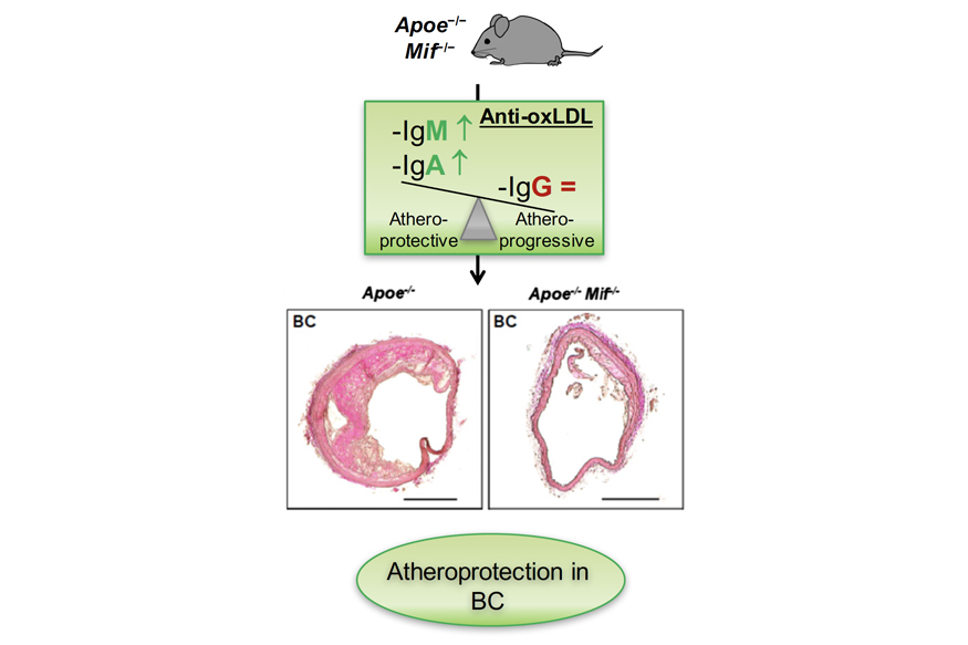 A novel link between the chemokine MIF and B lymphocytes in atherosclerosis