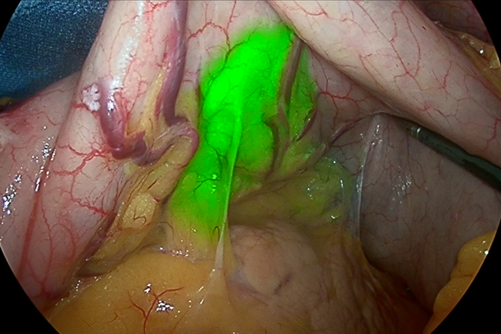 Image Guided Surgery