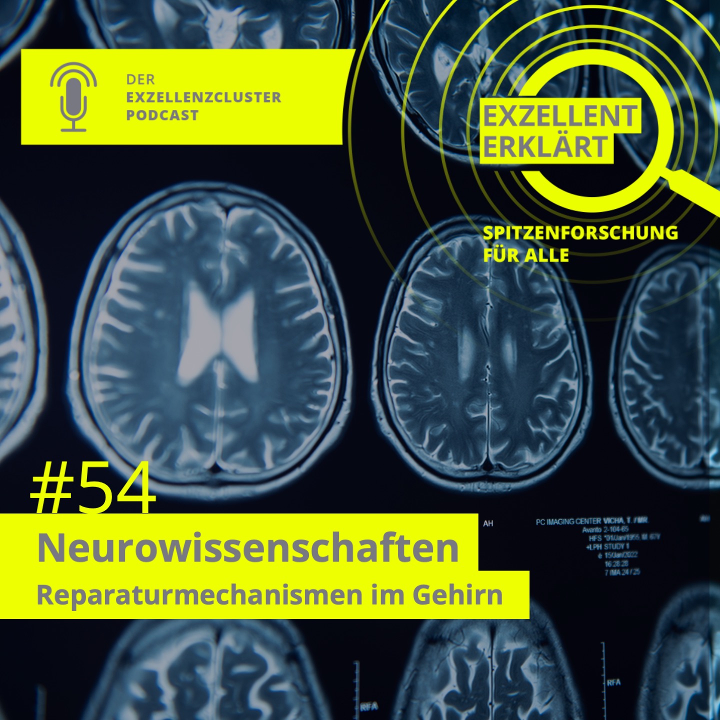   podcast cover exzellent erklärt #54