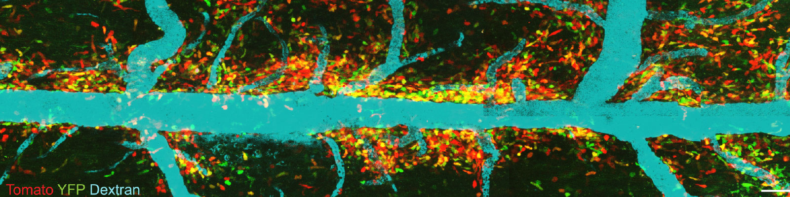Regulation of phagocyte responses in neuroinflammatory lesions