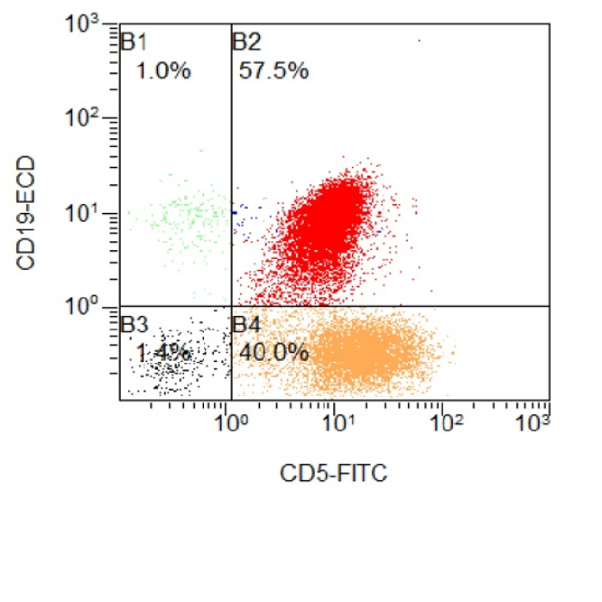 Grafik: Durchflusszytometrie (FACS: Fluorescence Activated Cell Sorting)