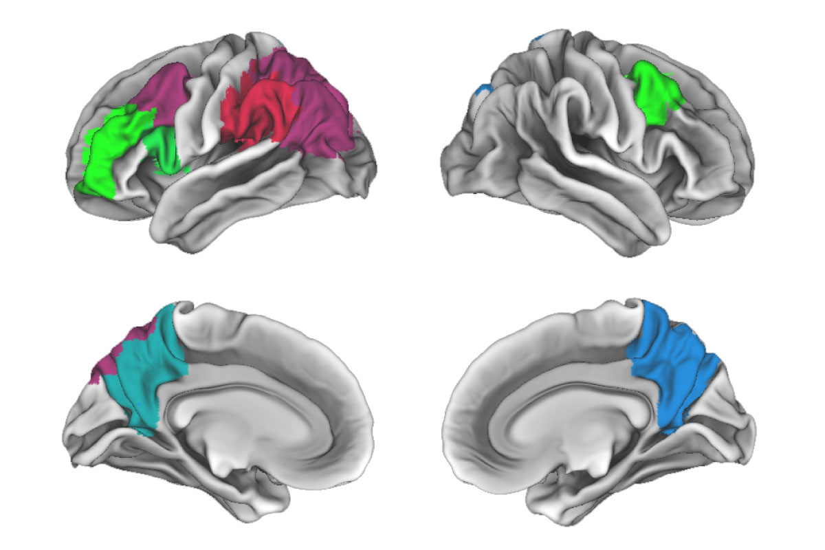 Alzheimer’s & Dementia 