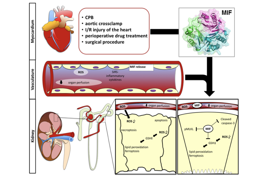 MIF protects from complications after cardiac surgery