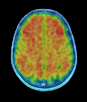 klinische Diagnostik Demenz