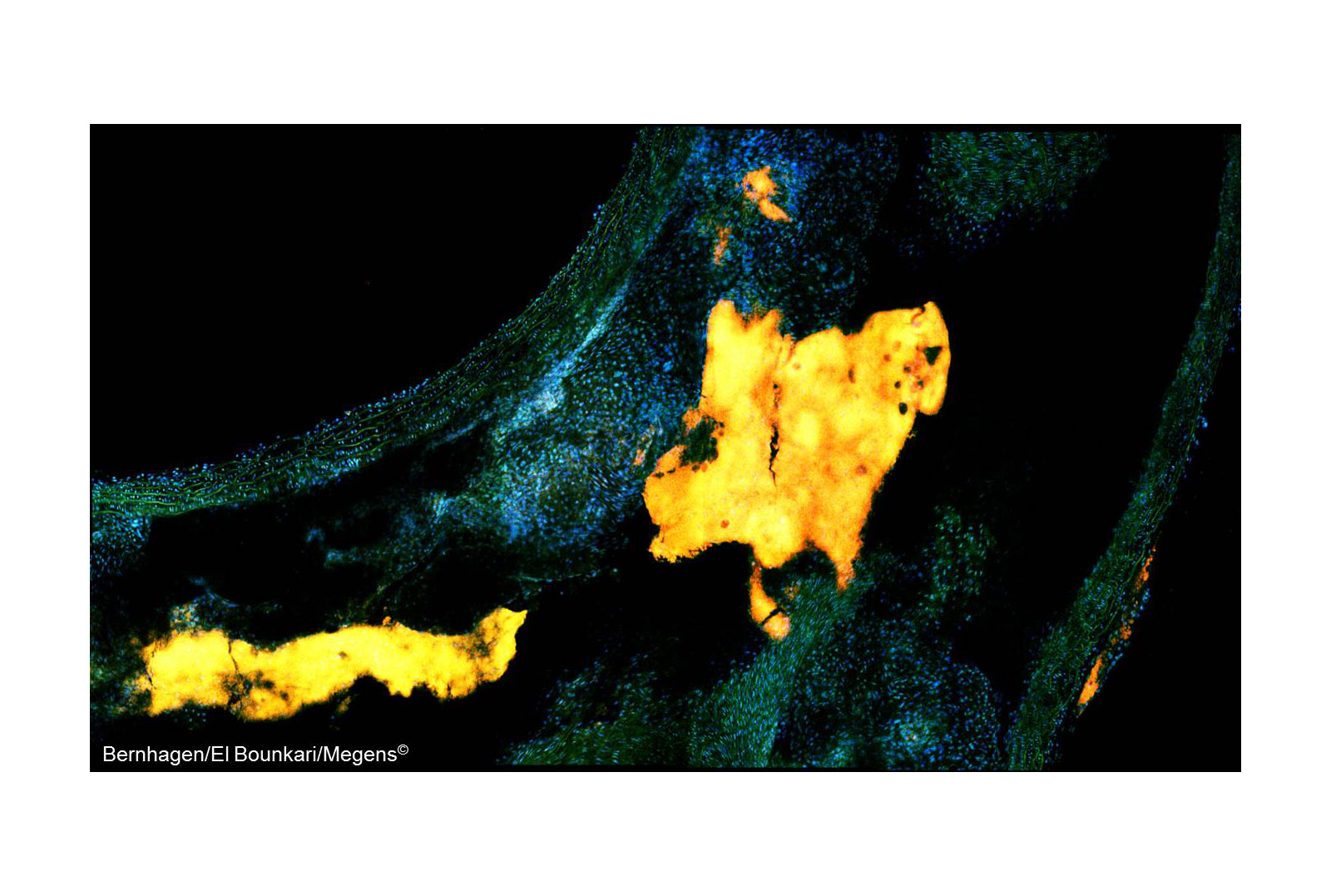 Multi Photon Microscopy