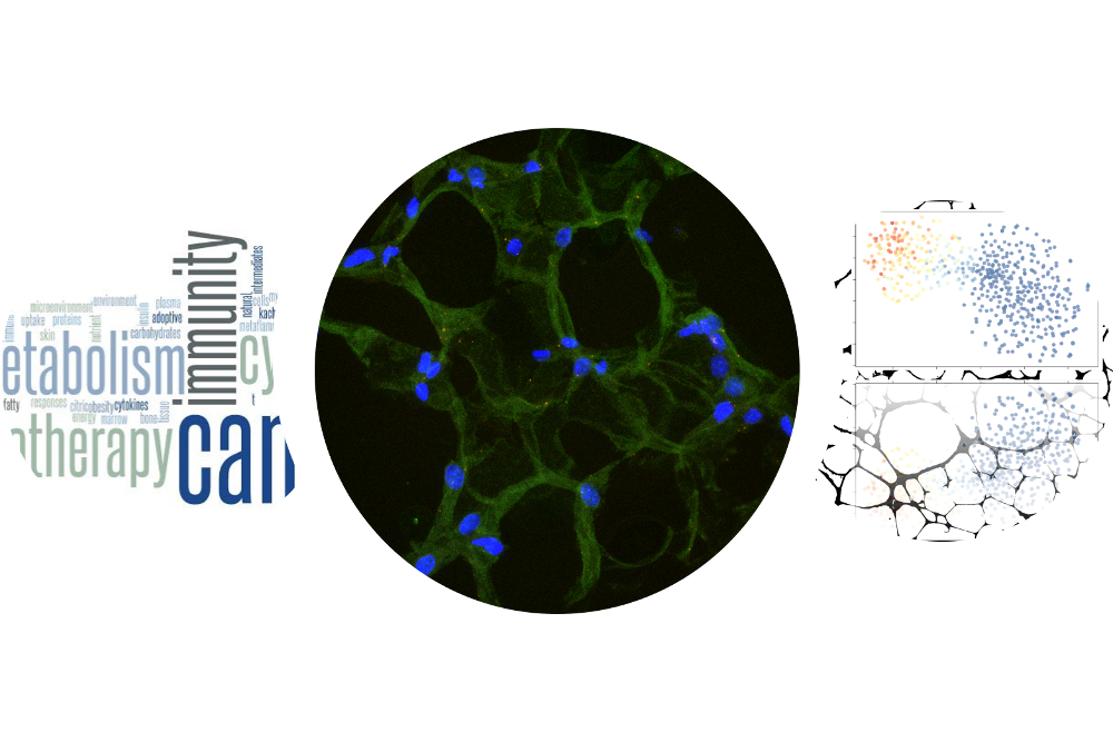 Logo: Cancer and Immunometabolism Research Group