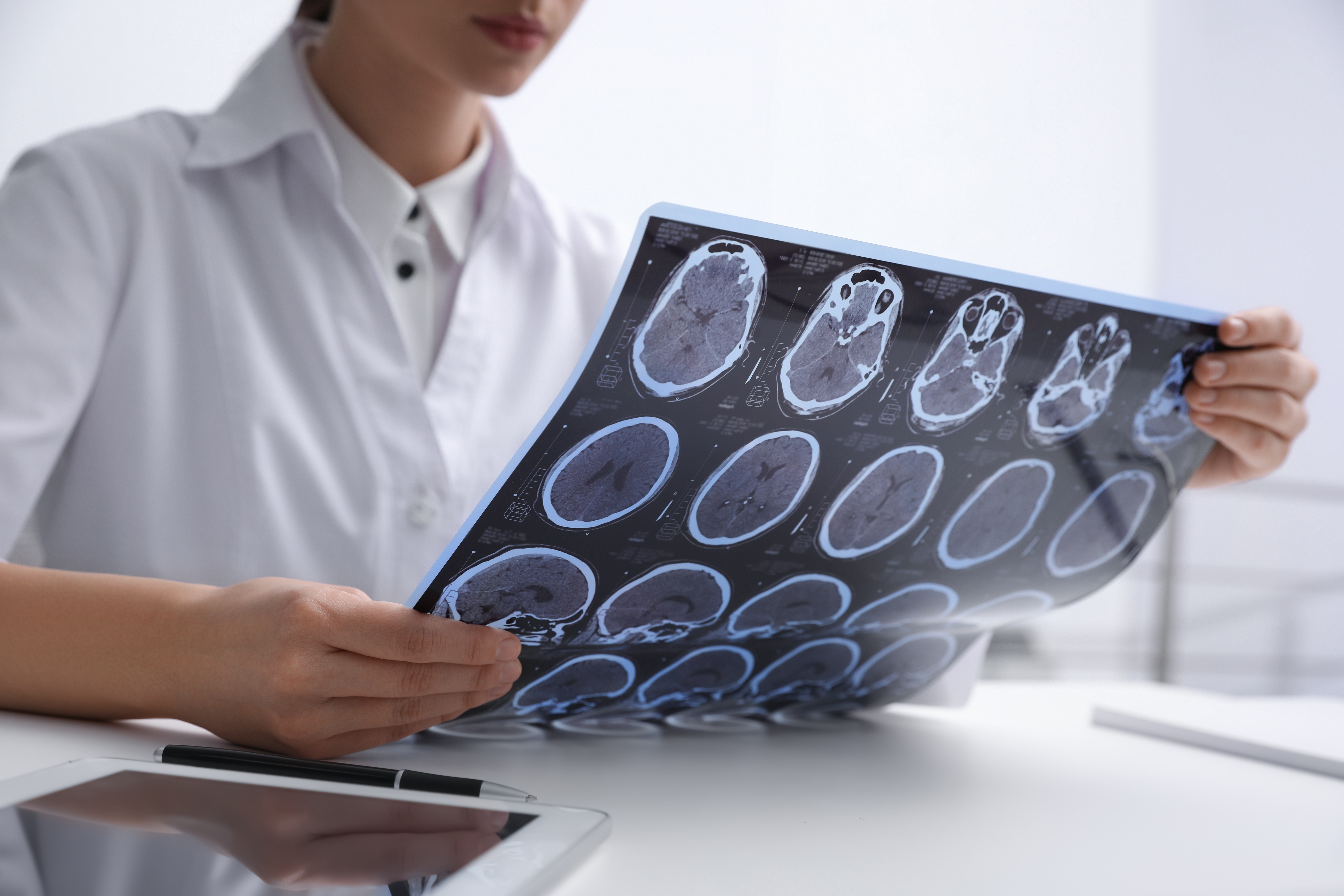  Person looking at MRI scans of the brain
