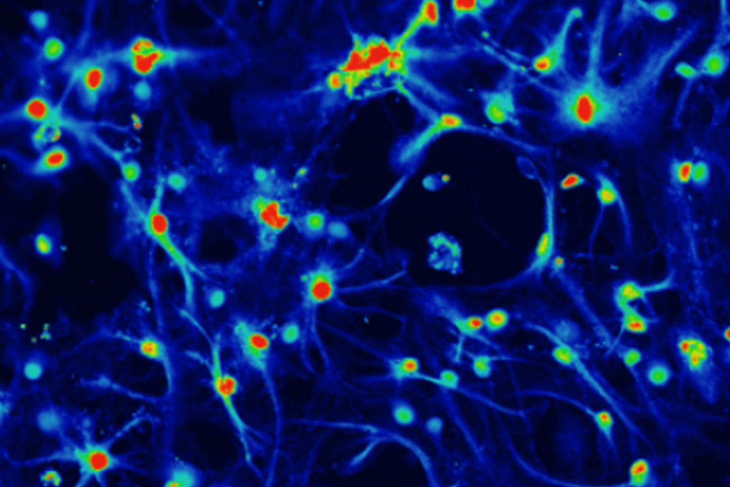 Bareyre Lab Image